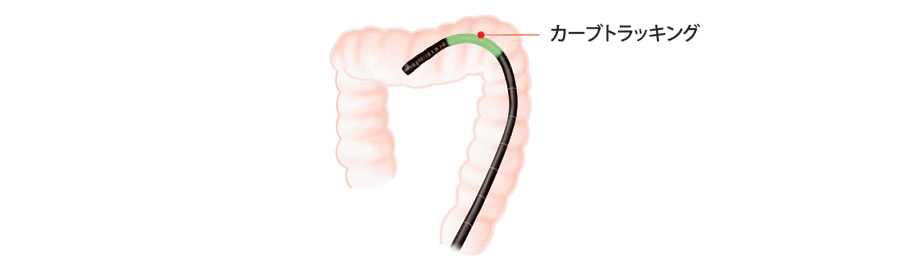 「 高追従挿入部」 と「 カーブトラッキング技術」